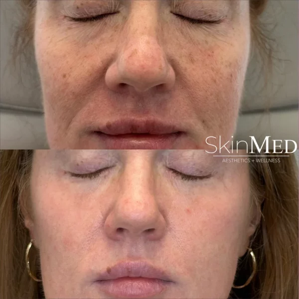 skinmedhealth-BA-amy-b-in-Chattanooga-TN