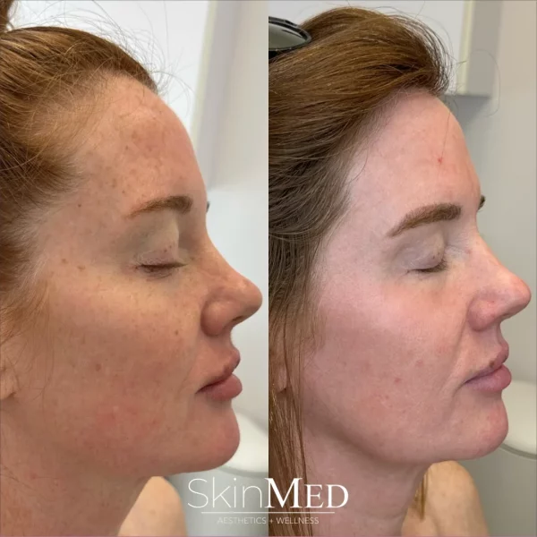 skinmedhealth-BA-amy-d-in-Chattanooga-TN