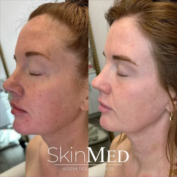 skinmedhealth-BA-amy-f-in-Chattanooga-TN