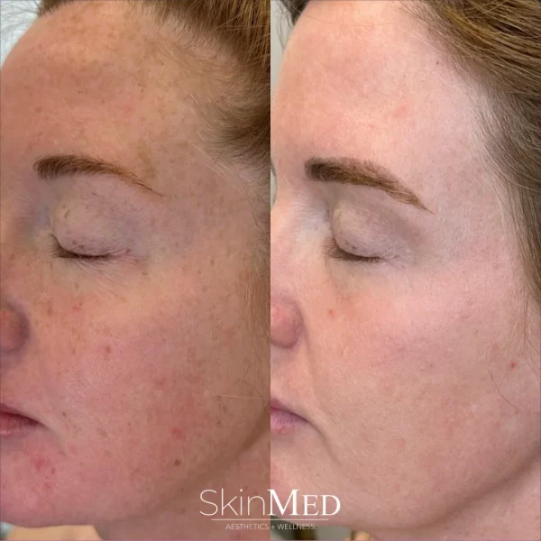 skinmedhealth-BA-amy-g-in-Chattanooga-TN