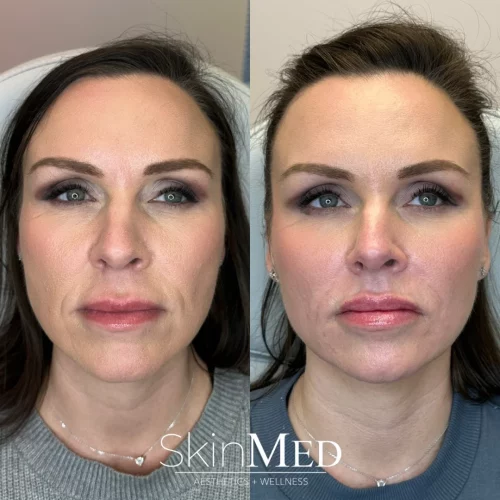 skinmedhealth-BA-gayle-full-face-in-Chattanooga-TN